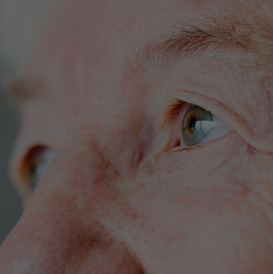 Cataract surgery and the risk of developing late stage age-related macular degeneration